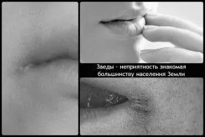 губах