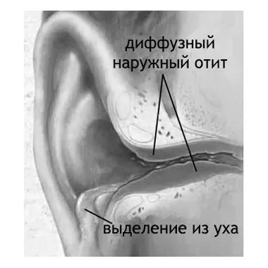 вуха