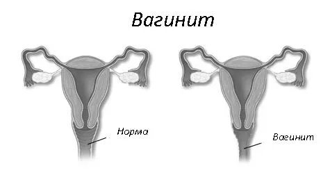 жінок