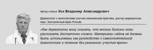 виділення