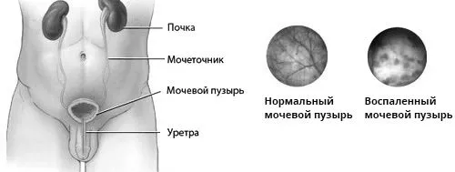 тягне