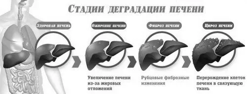 лікування