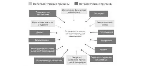 лікування пароксизмальної шлуночкової тахікардії
