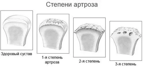 лікування