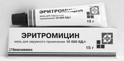 причини