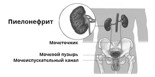 як вилікувати низ живота