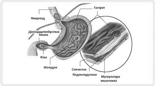алкоголь