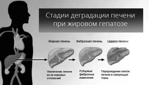 гепатоз