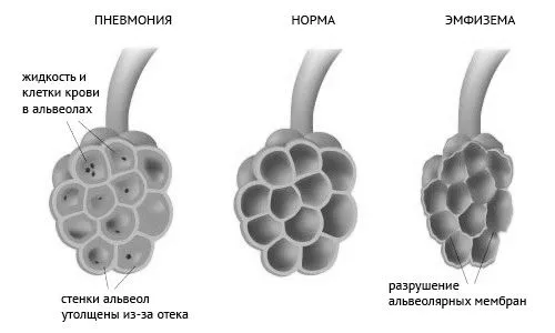 симптоми