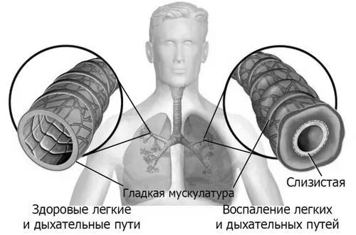 симптоми