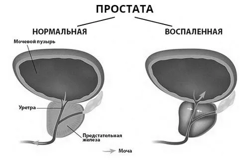 живота