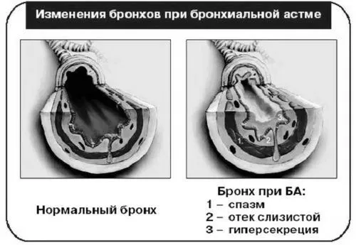 симптоми