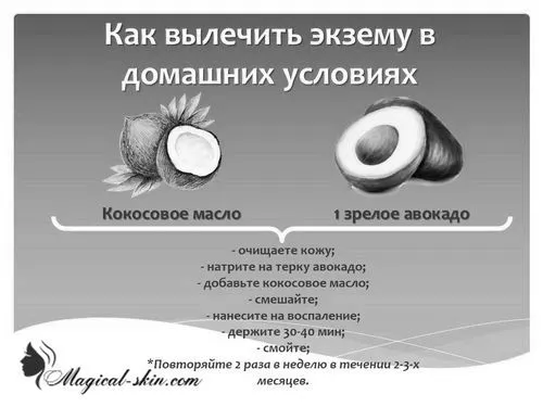 алергічна
