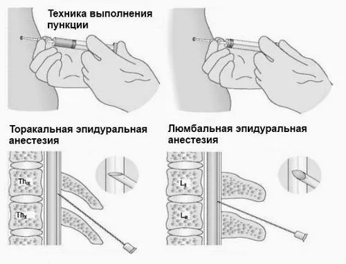 після