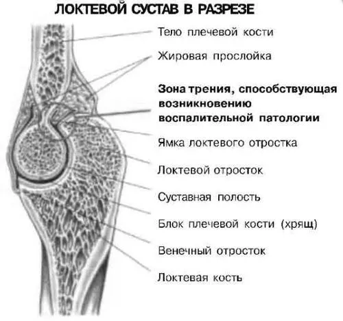 суглобі