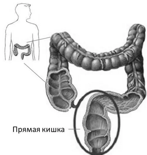 лікування