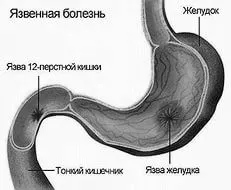 умовах