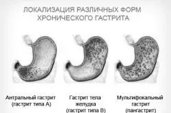 дієта