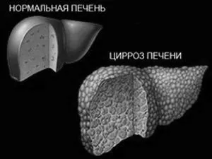 хвороби