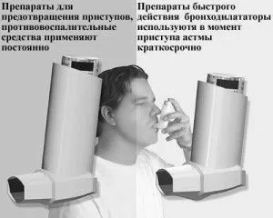 Бронхіальна астма: симптоми, причини виникнення, лікування симптоми