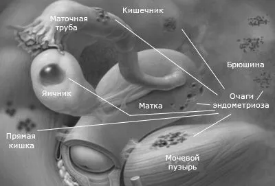 стінки