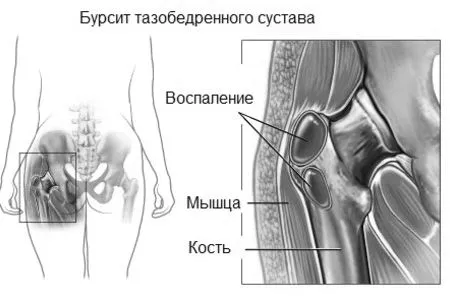 тазостегнового