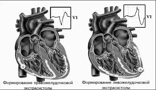 лікування