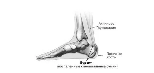 стопи