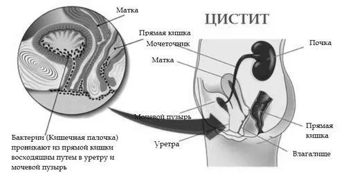 грудному