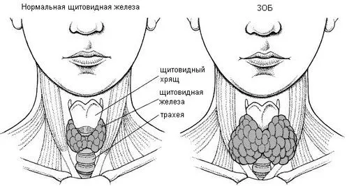 ступеня