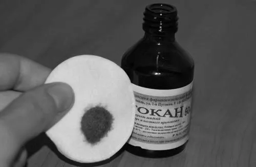 як лікувати флюс на яснах в домашніх умовах