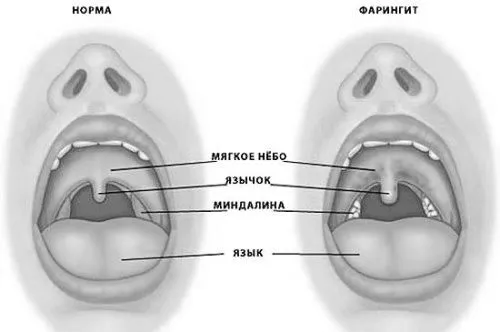 форми