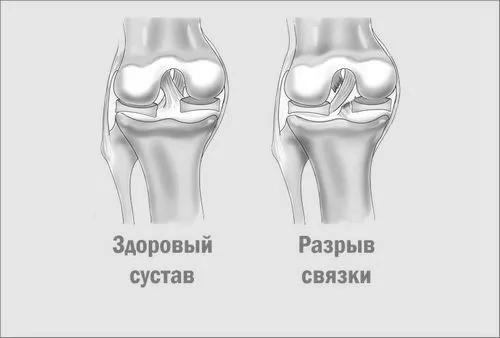язок