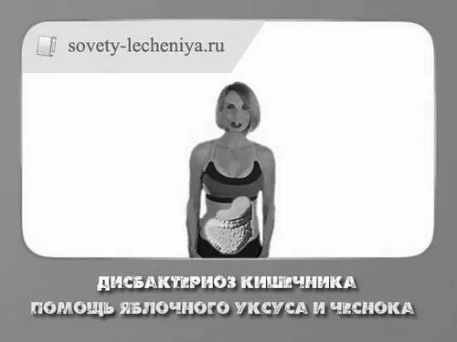 Дисбактеріоз кишечника лікування дисбактеріоз кишечника лікування