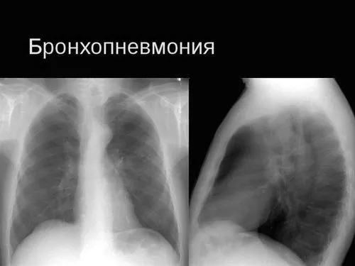 лікування