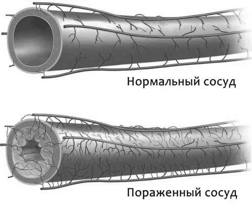 харчування