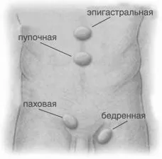 грижа живота видалення операція операція з видалення лікування народними засобами без операції як лікувати профілактика реабілітація після видалення