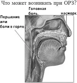 Які симптоми грз як лікувати ГРЗ влітку