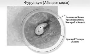 лікуванню