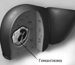 лікування