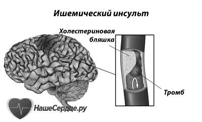 ознаки