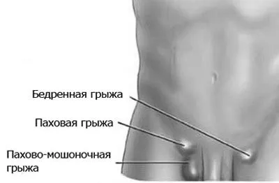гімнастика