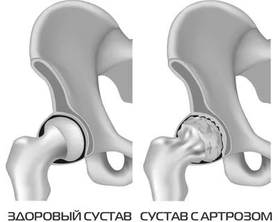 гімнастика