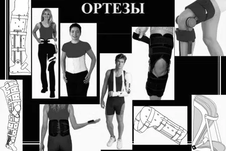 суглобів