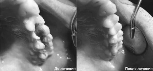 стадій