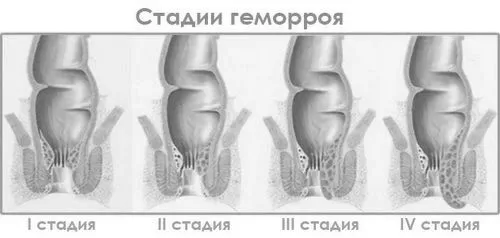 стадія
