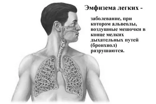 засоби