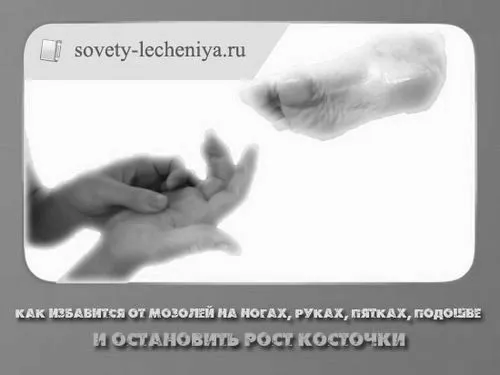 ногах