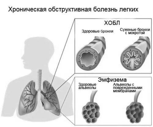 лікувати
