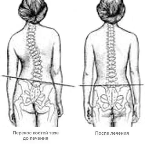 таза